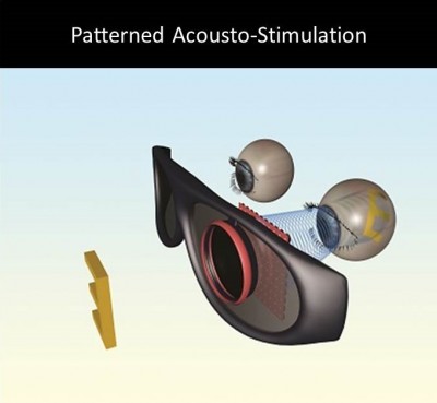 Patterned Acousto-Stimulation